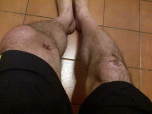 My knees the night before the race.